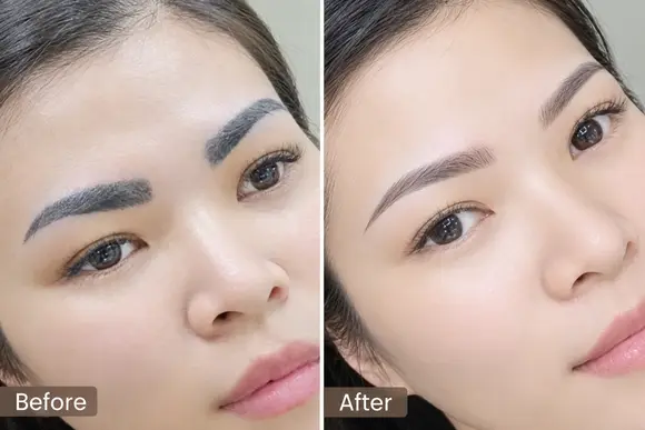 HÚT CHÂN MÀY BỊ XANH LEM - TRẢ LẠI ĐƯỜNG NÉT ĐẸP TỰ NHIÊN 