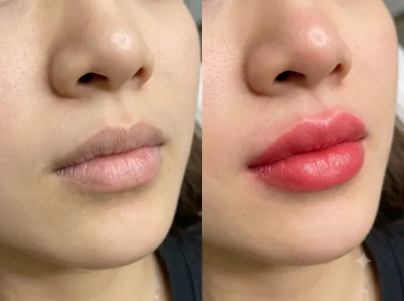 PHUN MÔI TỰ NHIÊN TRUYỀN THỐNG – CẢI THIỆN MÀU MÔI, TẠO SẮC MÔI HÀI HÒA