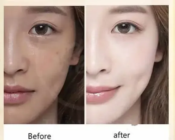 CẤY TRẮNG CÔNG NGHỆ CAO
