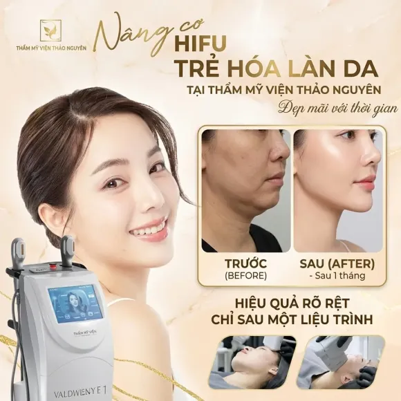 NÂNG CƠ HIFU – GIẢI PHÁP HỖ TRỢ SĂN CHẮC DA, CẢI THIỆN ĐƯỜNG NÉT KHUÔN MẶT